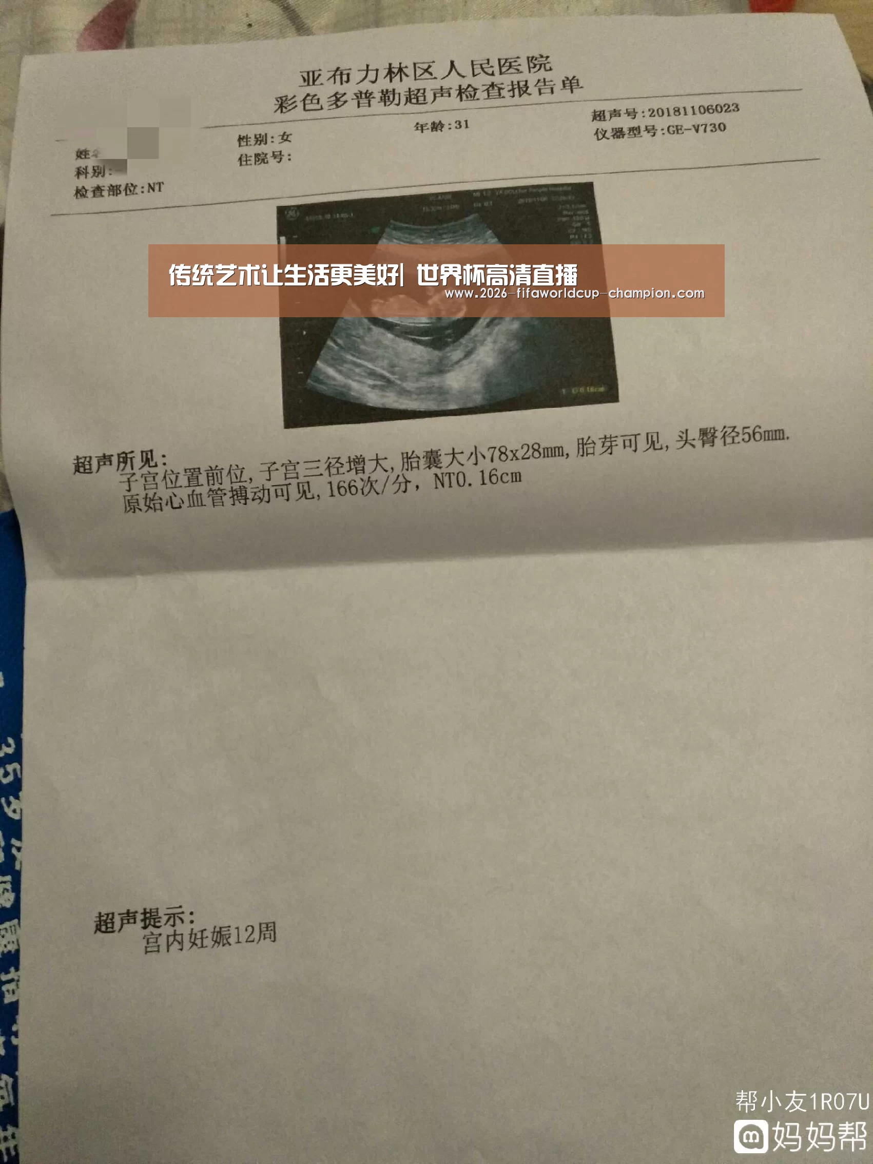 传统艺术让生活更美好| 世界杯高清直播(图3) 世界杯电竞平台